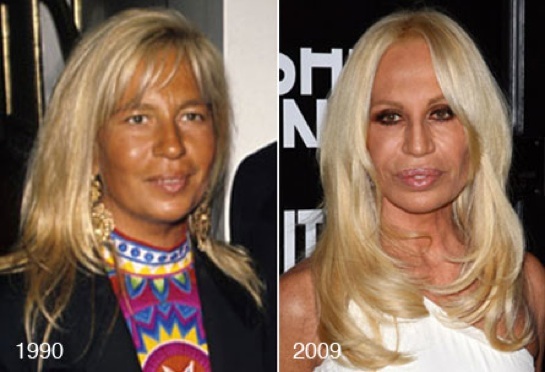 Famous Designer Donatella Versace’s More Bizarre New Look